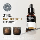 Advanced Hair Growth Serum with Redensyl, Rosemary & Rice Water - 30 ml
