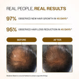 Advanced Hair Growth Serum Roll-On with Redensyl, Rosemary & Rice Water- 25 ml | Pack of 3