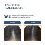 Anti-Hair Fall Shampoo with Adenosine & Peptides - 250 ml | Pack of 2