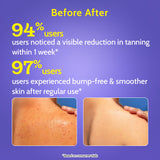 Exfoliating Body Wash with Lactic Acid & Salicylic Acid - 236 ml