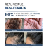 Anti-Hair Fall Shampoo with Adenosine & Peptides | 5X Hairfall Control - 250 ml