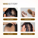 Hair Growth & Strength Combo (Hair Growth Serum Roll On - 25 ml | Anti-Hairfall Shampoo - 250 ml)