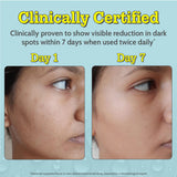 10% Vitamin C Serum for Glowing & Bright Skin - 10 ml