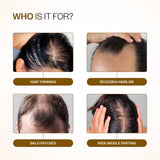 Advanced Hair Growth Serum Roll-On with Redensyl, Rosemary & Rice Water- 25 ml | Pack of 3