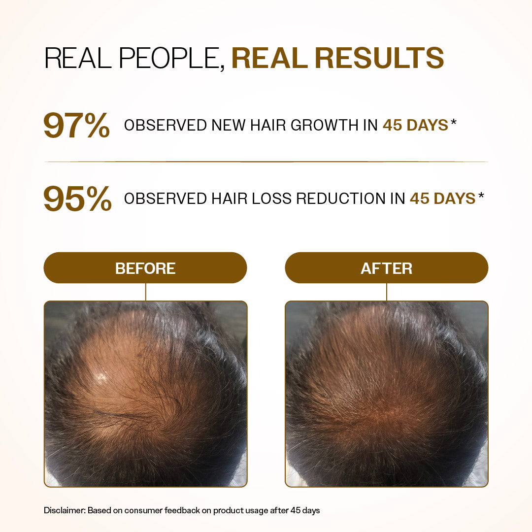 Advanced Hair Growth Serum Roll-On with Redensyl, Rosemary & Rice Water- 25 ml | Pack of 3