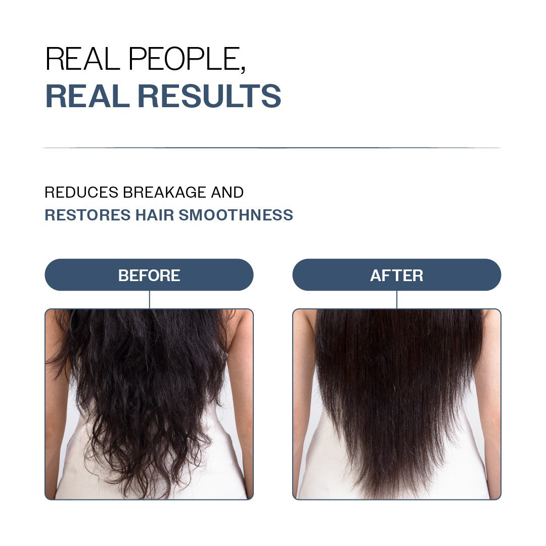 Anti-Hair Fall Conditioner with Redensyl, Rosemary & Peptides for Hair fall & Thinning - 175 gm