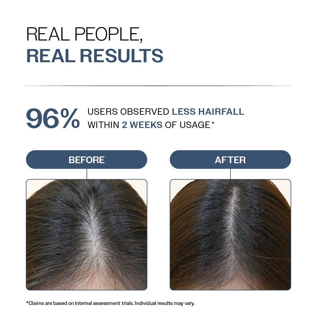 Anti-Hair Fall Shampoo with Adenosine & Peptides - 100 ml | Pack of 2