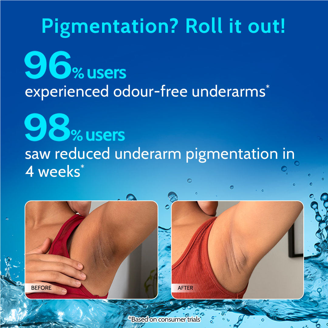 5% AHA Underarm Roll on for Odour Control & Pigmentation (Aqua) - 40 ml