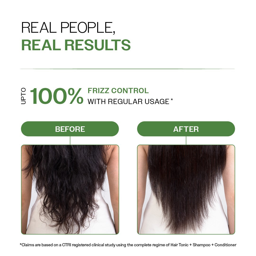 Anti-Dandruff Hair Conditioner with Salicylic Acid, Biotin & Rosemary - 175 gm | Pack of 3