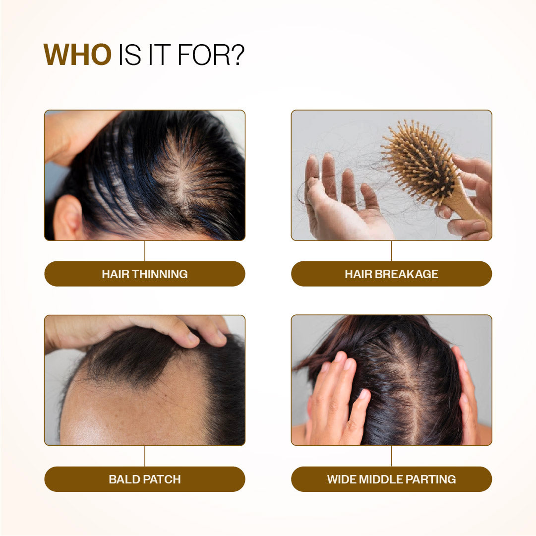 Hair Growth & Strength Combo (Hair Growth Serum Roll On - 25 ml | Anti-Hairfall Shampoo - 250 ml)