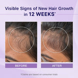 Rosemary & Hibiscus Hair Growth Oil with Redensyl & Biotin - 100