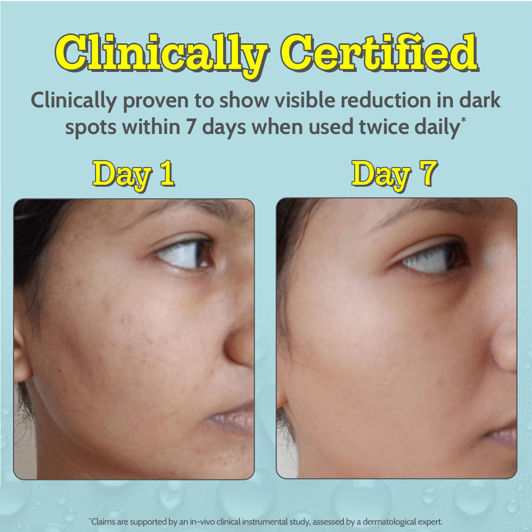 10% Vitamin C Serum for Glowing & Bright Skin - 10 ml