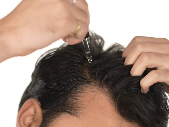 STEP 1